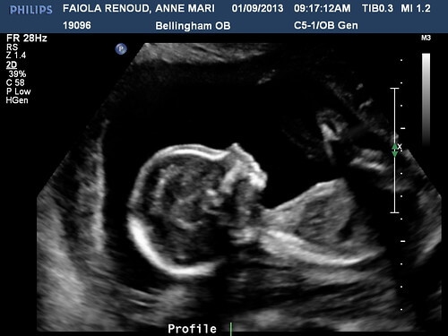 FAIOLA RENOUDANNE MARIE20130109091712605