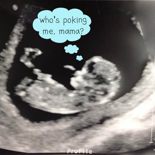 Ultrasound Ultrasound